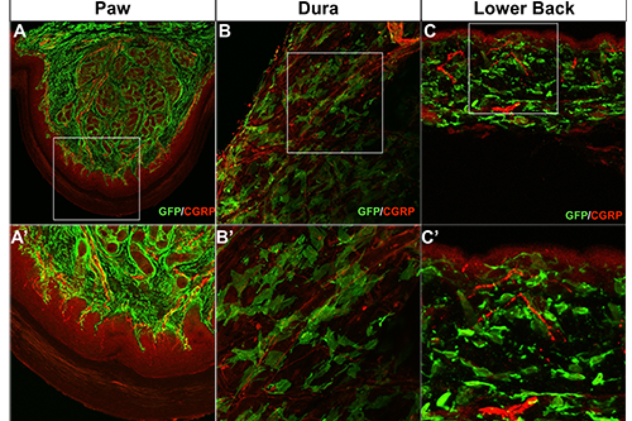 Using genetic strategies, I can target ChannelRhodopsin to specific cellular populations to allow me to control neuronal activation w/ light. This technique is called optogenetics.